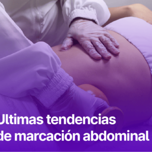 Últimas tendencias de Marcación Abdominal