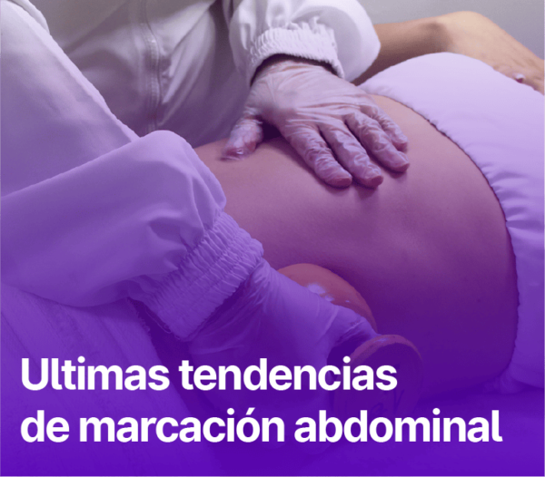 Últimas tendencias de Marcación Abdominal